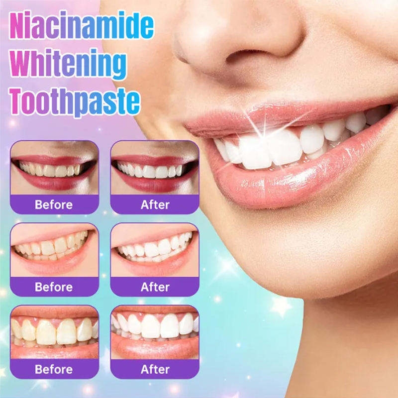 Niacinamide Whitening Toothpaste Instant Teeth Whitening